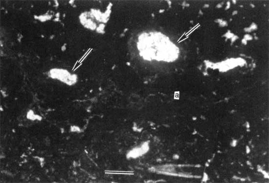 Black and white photo of thin section.