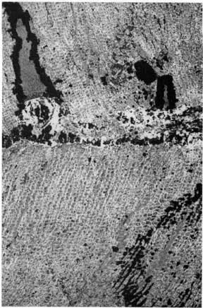 black and white photomicrograph from Mineral coal