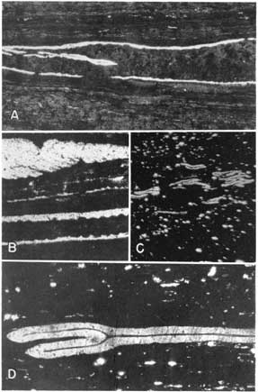 4 black and white thin sections from Mineral coal