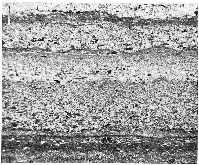 black and white photo of thin section