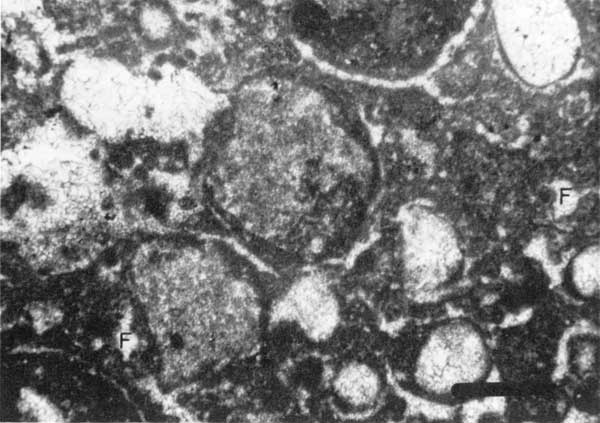 Black and white photo of thin section.