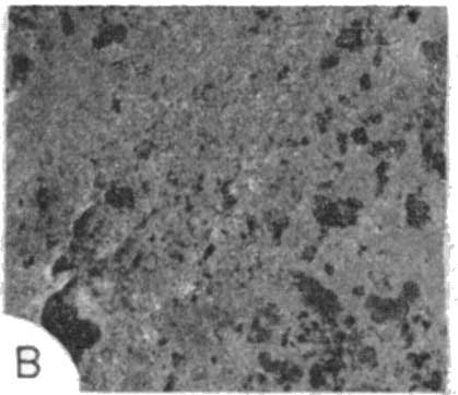 photomicrograph 1b