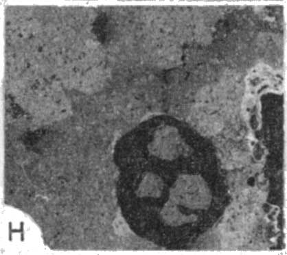 photomicrograph 1h