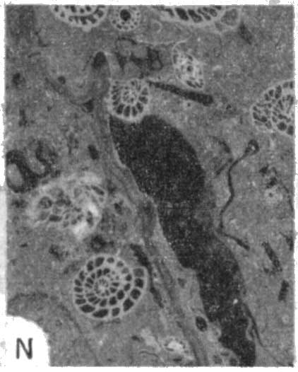 photomicrograph 1n