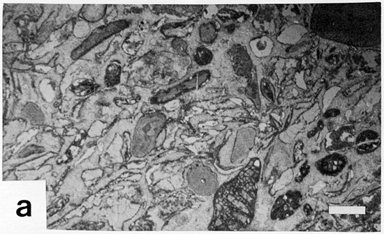 Black and white photomicrograph.