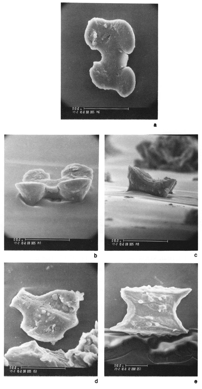 Five black and white scanning-electron microscope photos of grass phytoliths.