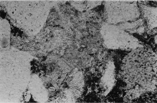 Black and white photomicrograph.