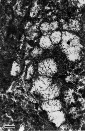 Black and white photomicrograph of alveolar structure from figure 12.