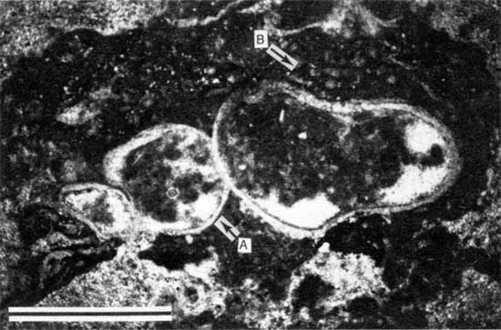 Black and white photomicrograph of Americus Limestone Member, Spirorbis-foraminifer-alga boundstone from locality 11.