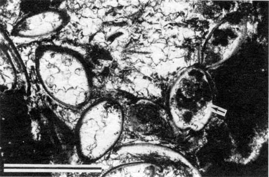 Black and white photomicrograph of Americus Limestone Member, ostracodes and Calcivertella from locality 18.
