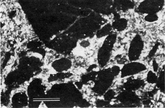 Black and white photomicrograph of Americus Limestone Member, wackestone to packstone from locality 29.