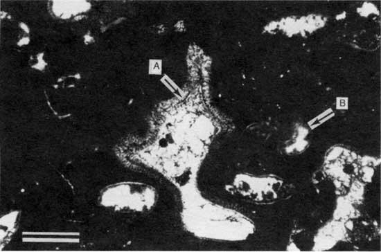 Black and white photomicrograph of pendant PF2 cement.