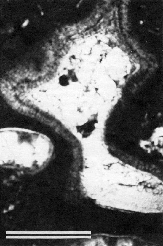 Black and white photomicrograph of pendant cement, close up.