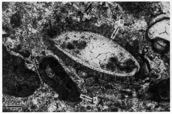 Black and white photomicrograph of Americus Limestone Member, foraminifer and ostracode.
