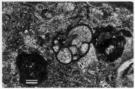 Black and white photomicrograph of Americus Limestone Member, Globivalvulina.