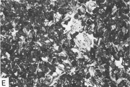 Black and white photomicrograph.