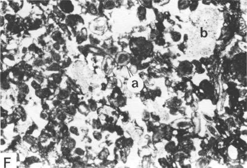 Black and white photomicrograph.