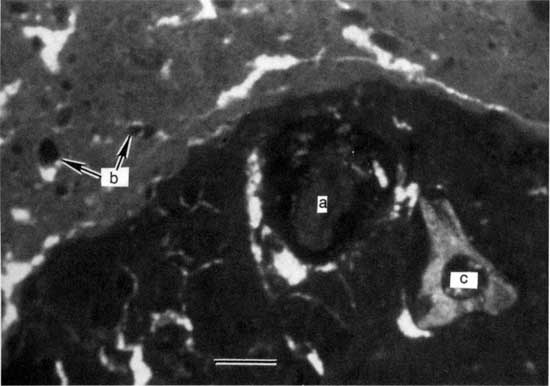 Black and white photo of thin section.