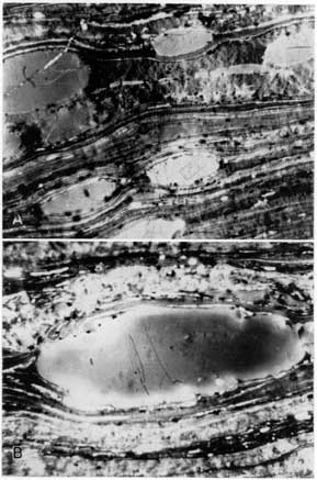 2 black and white thin sections from Bevier coal