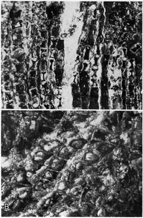 2 black and white photomicrographs