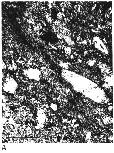 black and white photo micrograph