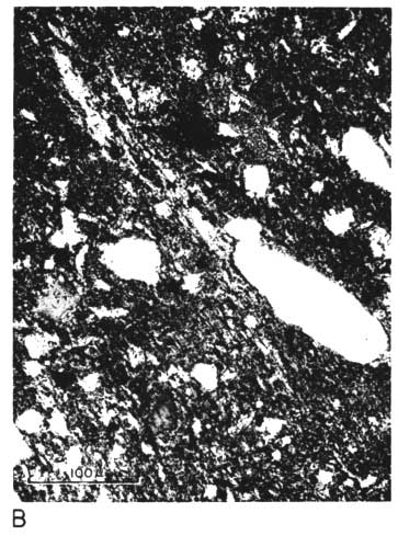 black and white photo micrograph