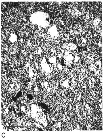 black and white photo micrograph