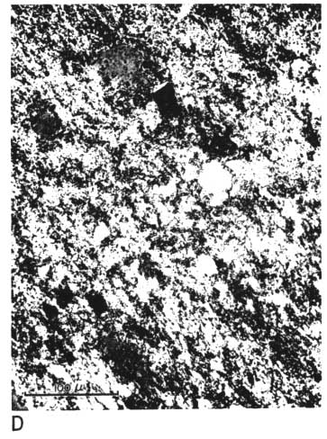 black and white photo micrograph