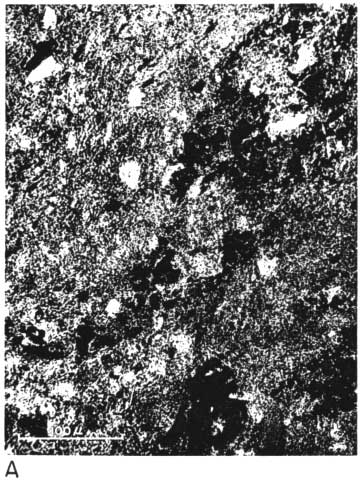 black and white photo micrograph