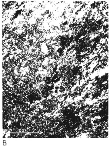 black and white photo micrograph