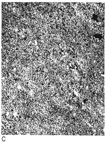 black and white photo micrograph