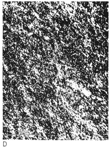 black and white photo micrograph