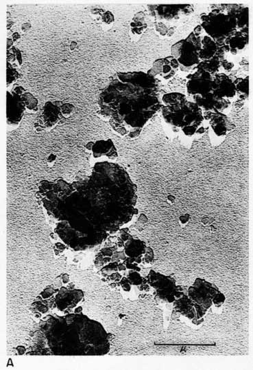 black and white electron micrograph