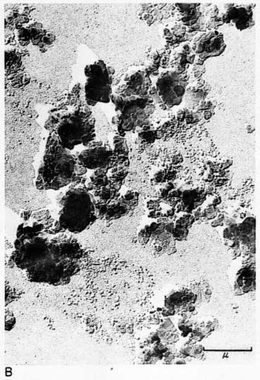 black and white electron micrograph