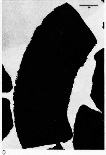 black and white electron micrograph