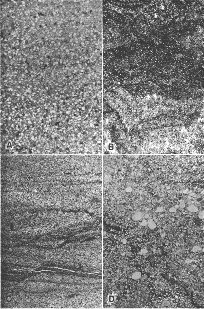 Four photomicrographs