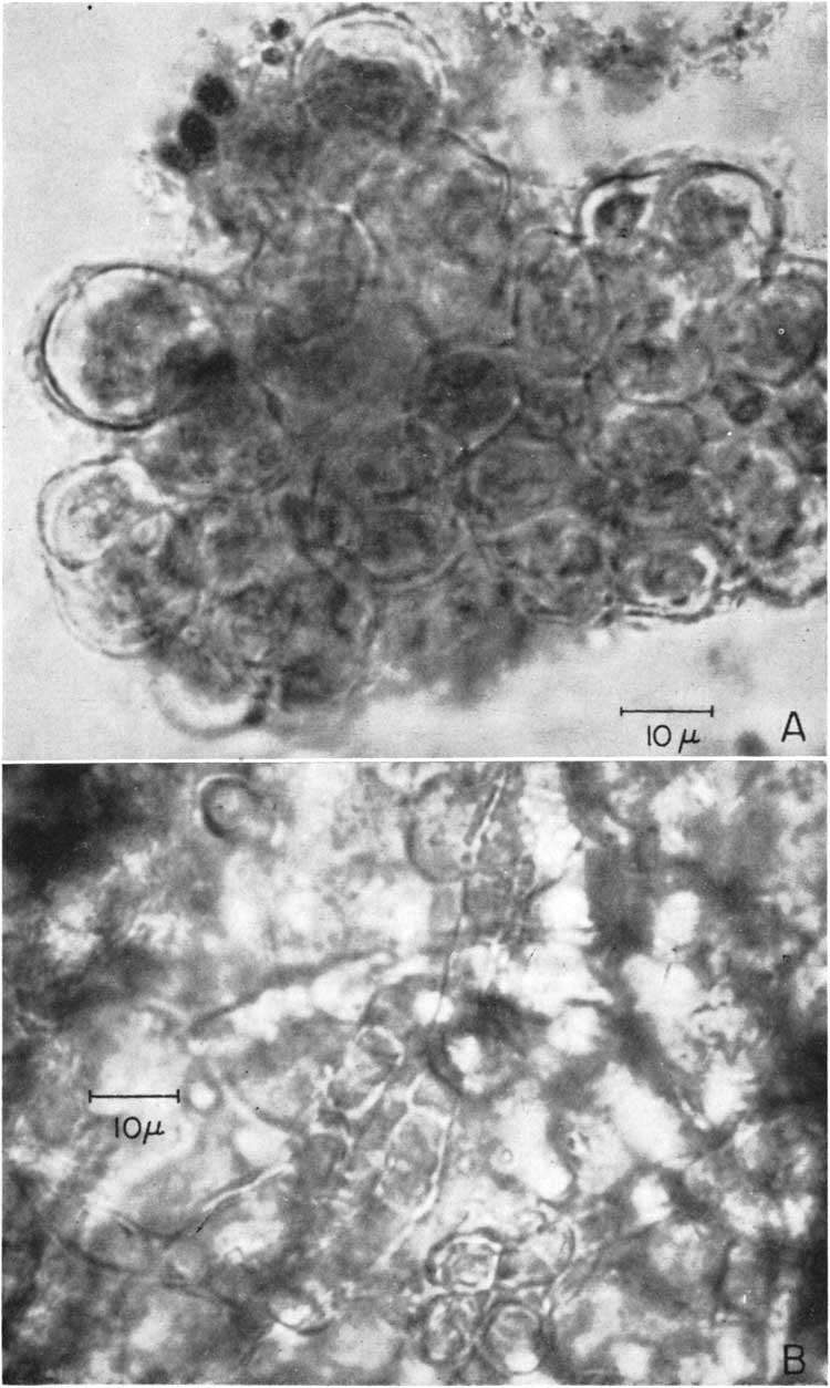 Two black and white photomicrographs, described in caption.