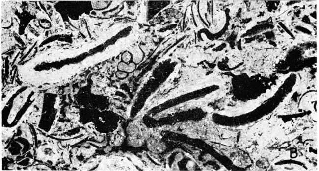 Black and white photomicrograph; many, many shell fragments.