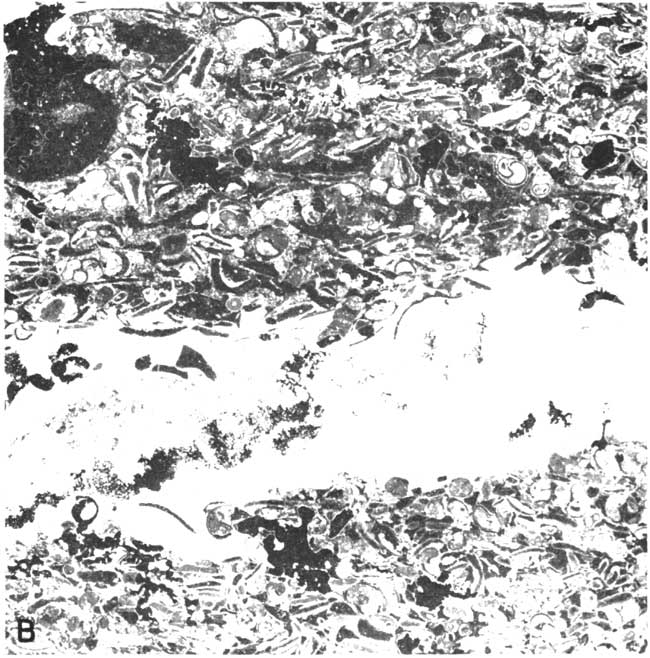 Black and white photomicrograph.