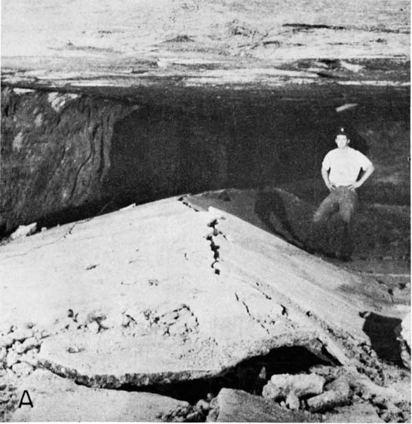 Black and white photo of man in salt room, buckle to side is fractured at crest.