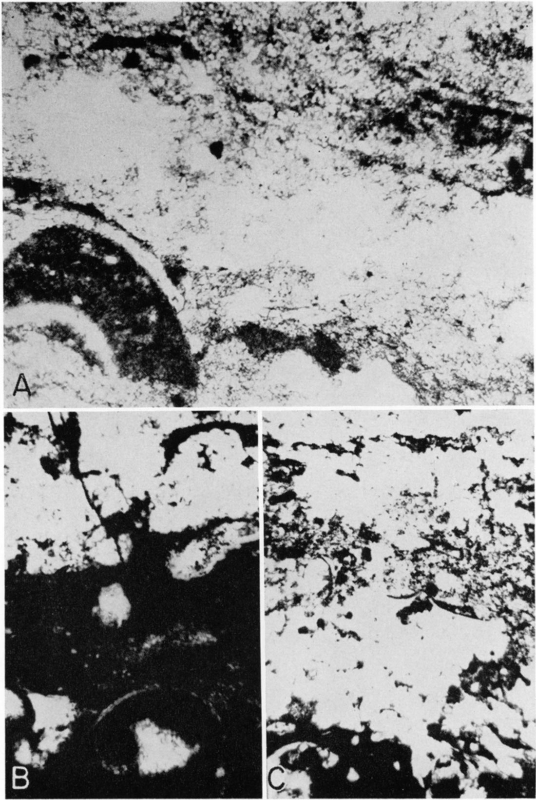 Three black and white photomicrographs of gradational contact of underlying limestone with gypsum in Easly Creek Shale.