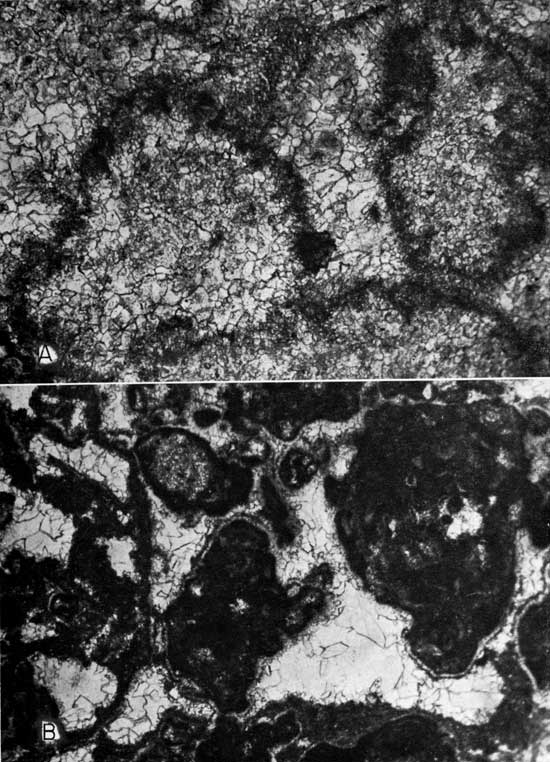 Two black and white micrographs.