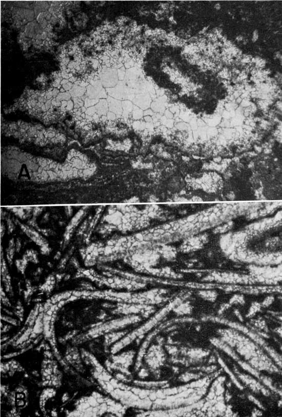Two black and white micrographs.