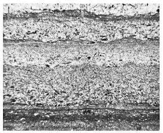 black and white photo of thin section