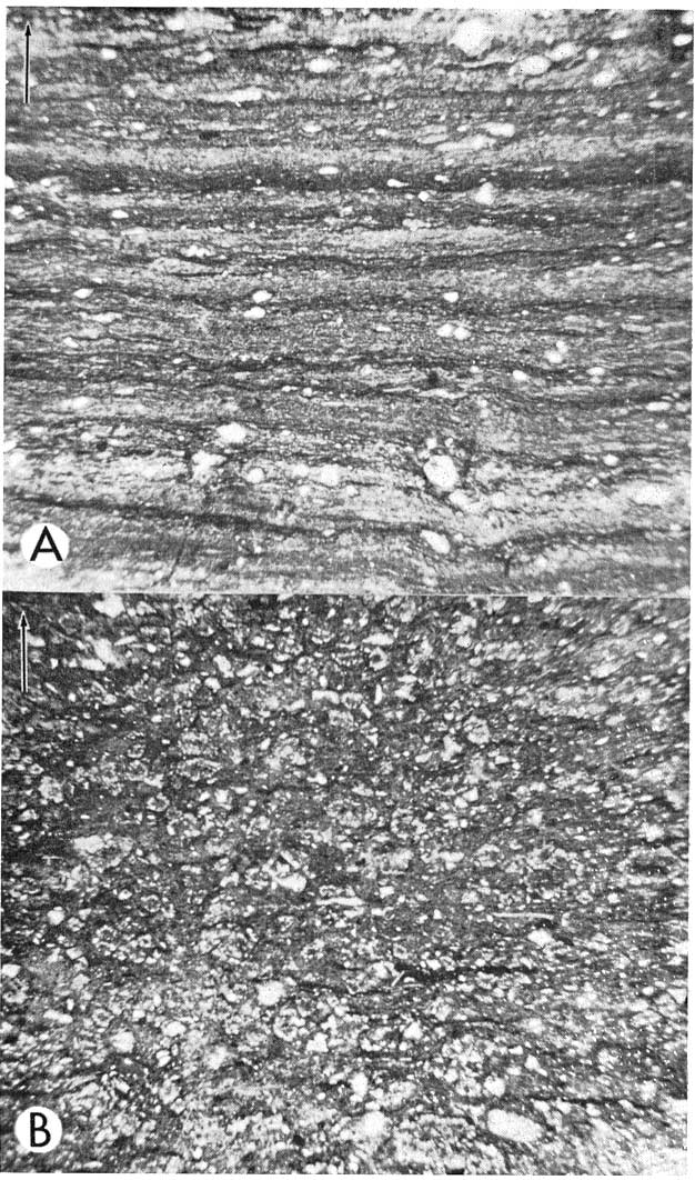 black and white photos of two thin sections