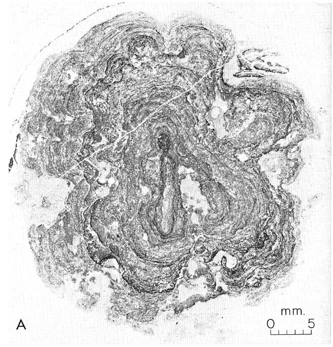 Black and white photo of nodule from Nixon Gulch Locality no. 8