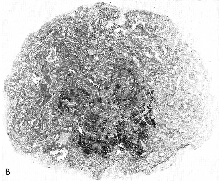 Black and white photo of nodule from Antelope Valley Locality no. 7