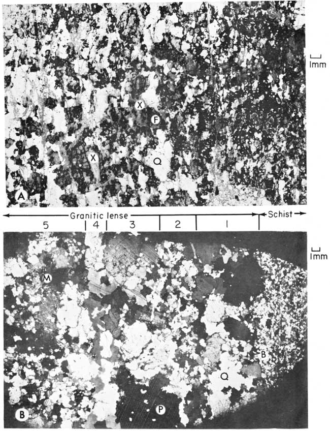 Two black and white photomicrographs.