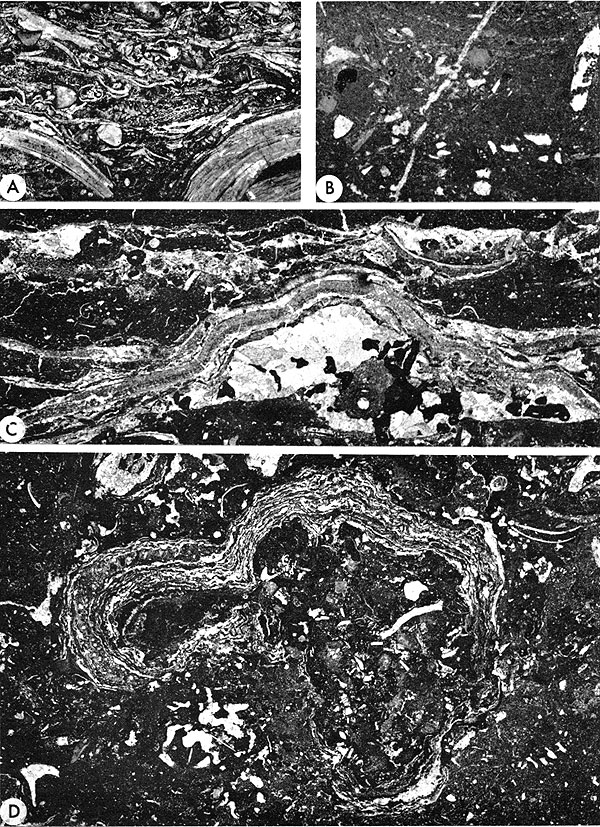 Four black and white photomicrographs.