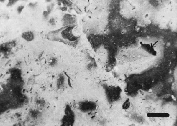 Black and white photo of biomicrite.
